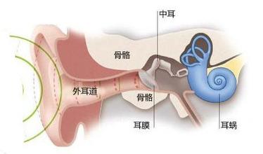 我感到耳鸣，怎么办？