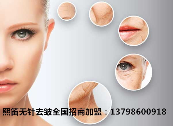 凱進無針去皺招商