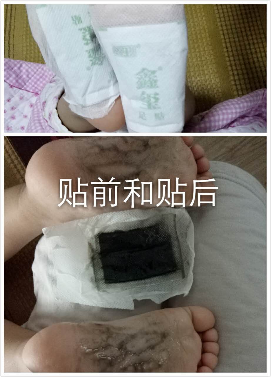 鑫璽足貼供應商哪家好，出售鑫璽足貼