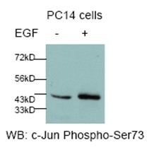 進(jìn)口規(guī)格全——口碑好的c-Jun(P-Ser73) 抗體哪里買