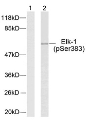 抗體進(jìn)口，南京哪家Elk-1(P-Ser383)抗體供應(yīng)商好