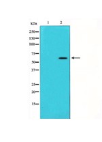 推荐AKT(P-Ser473)抗体【荐】，抗体AKT(Phospho-Ser473)Antibody